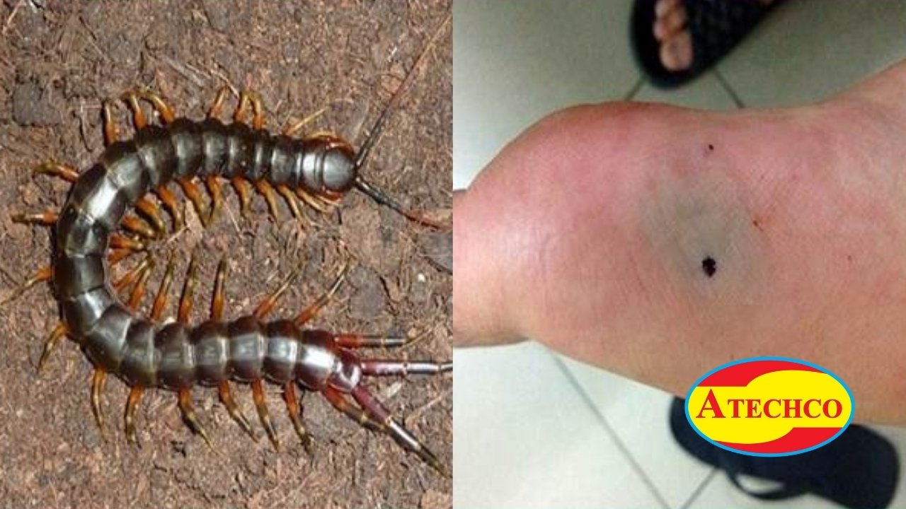 Biện ph&aacute;p ph&ograve;ng tr&aacute;nh v&agrave; xử l&yacute; rết trong nh&agrave; hiệu quả